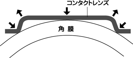 OK(Ortho Keratology)レンズの断面図